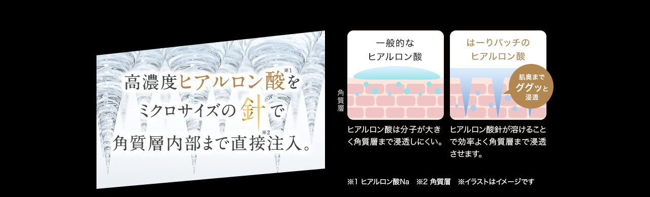 高濃度ヒアルロン酸をミクロサイズの針で角質層内部まで直接注入。